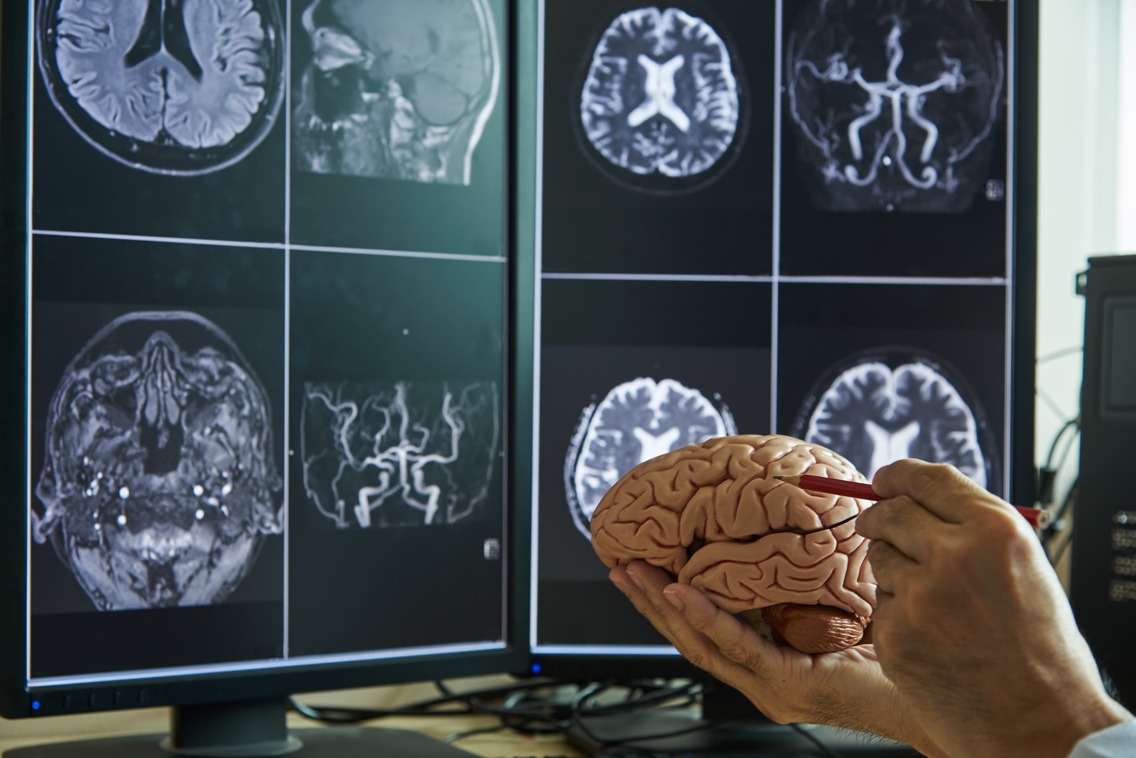 Gray Matter Analysis
